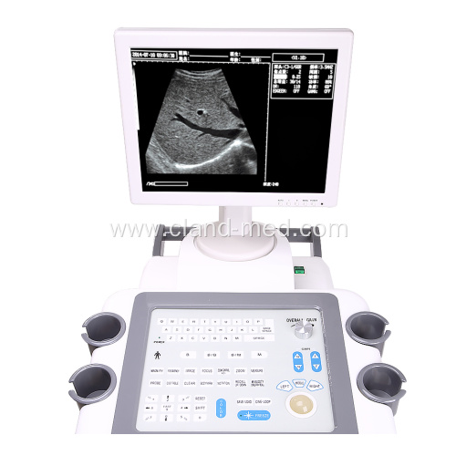 B/W Trolley Ultrasound Scanner Good Price Ultrasound Machine
